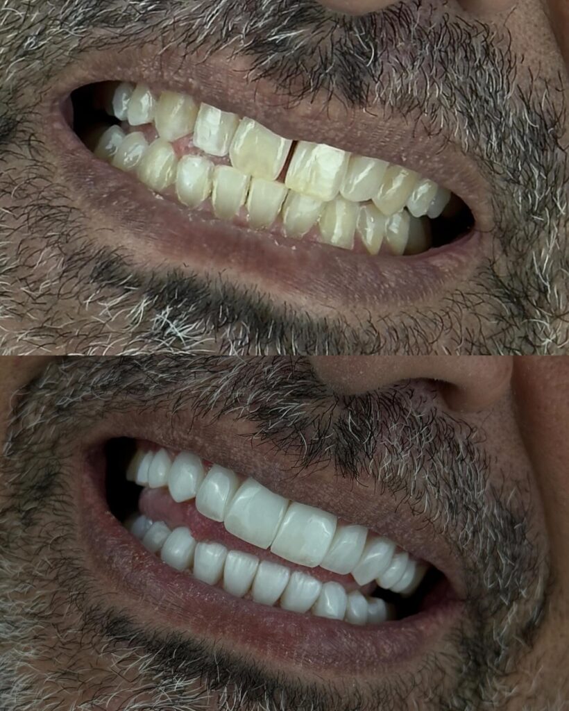 536363210_17919856725120474_2559475469947231493_n